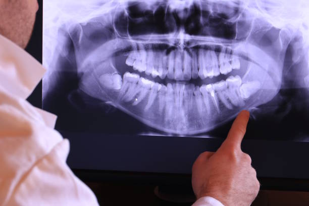 Best Pediatric Emergency Dentist in Cozad, NE