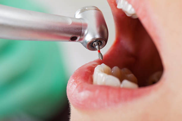 Best Emergency Broken Tooth Repair in Cozad, NE